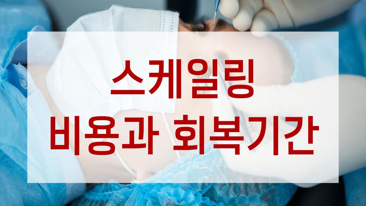 스케일링 비용과 회복기간